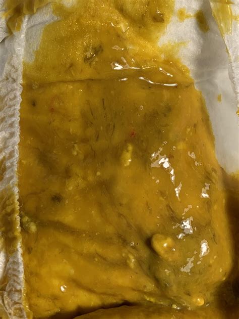 Black Stringy Mucus Mucus In Baby Poop | Enfamil