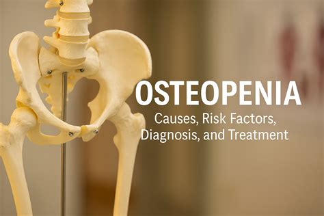 Osteopenia: Causes, Diagnosis & Functional Medicine Solutions – Revolution Health & Wellness