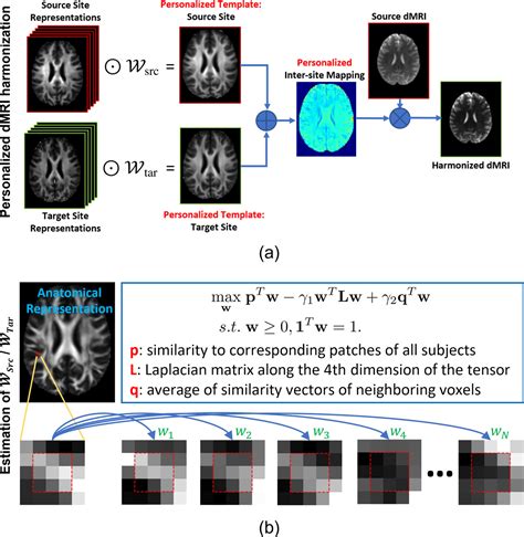 Image result for Brain Mapping Research
