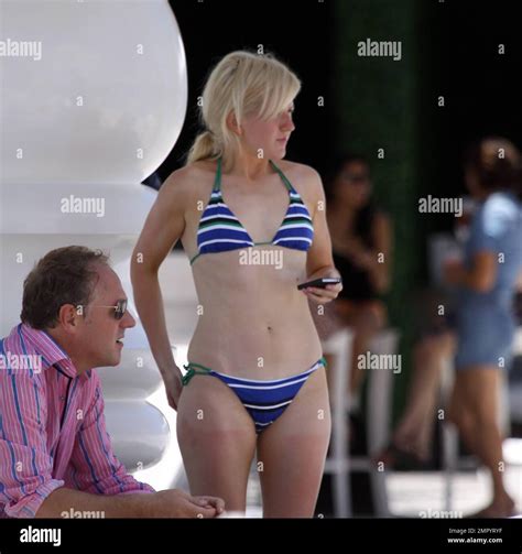 Fair skinned British singer Ellie Goulding appears to be suffering from ...