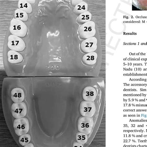 Image result for FDI World Dental Federation notation FDI Notation Examples