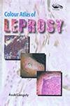 Buy Colour Atlas of Leprosy Book Online at Low Prices in India | Colour ...