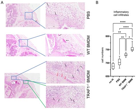 TRAF1 Deficiency in Macrophages Drives Exacerbated Joint Inflammation ...