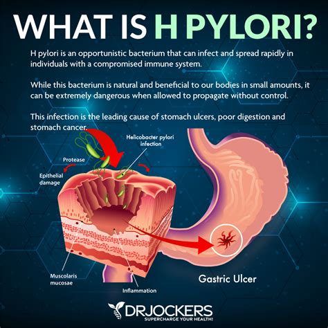 How Does H. Pylori Transmitted at Clifford Bloss blog