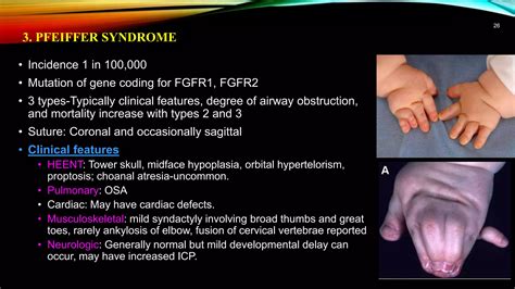 Anesthesia management of Craniosynostosis | PPTX