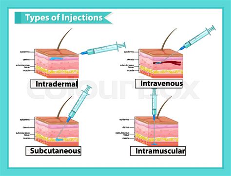 Image result for All Types of Injection
