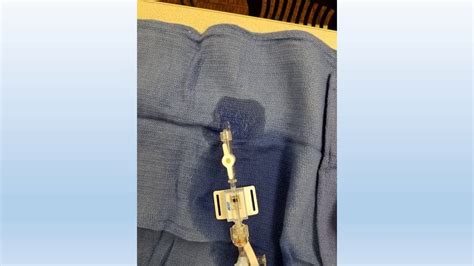 Image result for Manifold Cath Lab