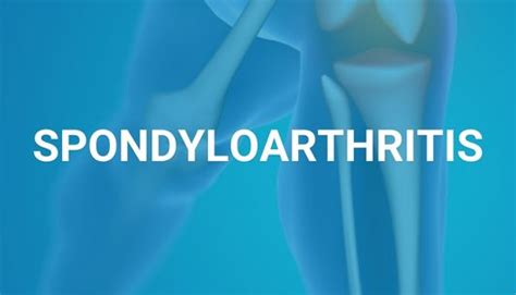 Treat-to-target dose reduction and withdrawal strategy of TNF ...