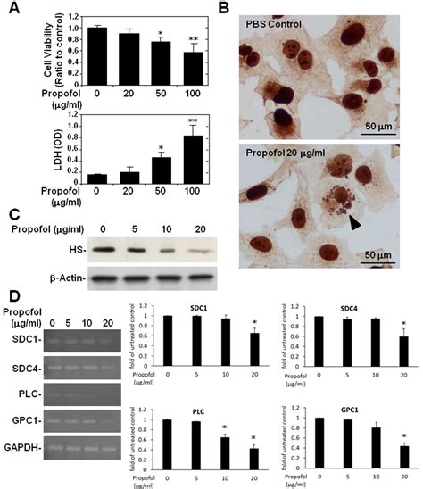 Image result for Propofol Overdose