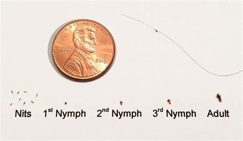 Lice 101: Get to Know the Enemy - Center for Lice Control