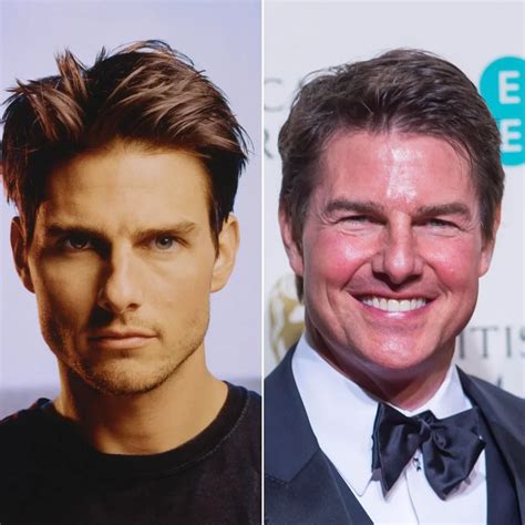Tom Cruise Plastic Surgery Face