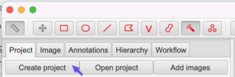 Image result for QuPath Basics