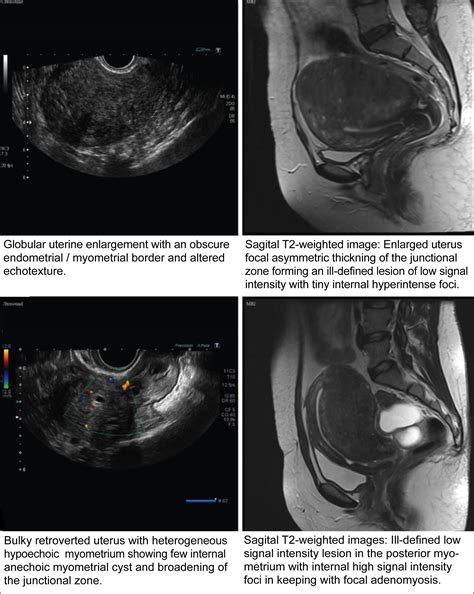 Ultrasonography Vs Ultrasound Obstetric Ultrasound Diagnostic