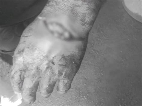 Hearing on stray dogs in Supreme Court today
