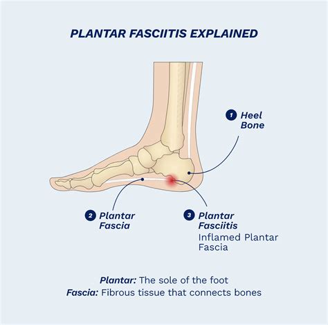 Plantar Fasciitis Shoes