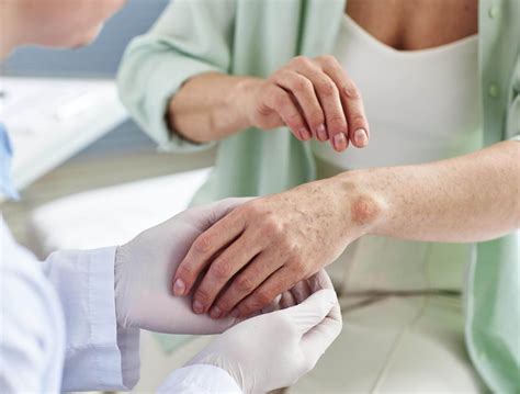 Bladder Spasms 的图像结果