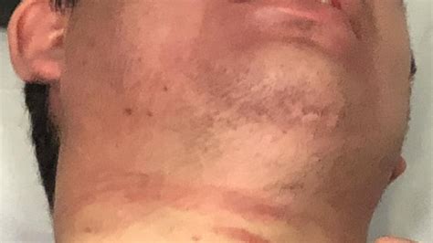 Image result for Strangulation Films