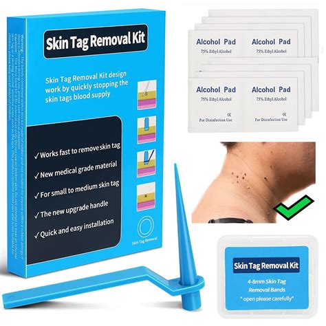 Micro Band Non Toxic Face Care Mole Wart Tool For Small To Medium Blue ...