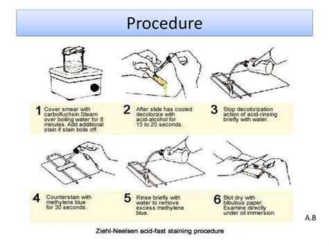 Image result for Acid-Fast Staining Method