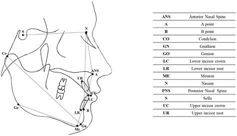 The Efficacy of the RME II System Compared with the Sander Bite-Jumping ...