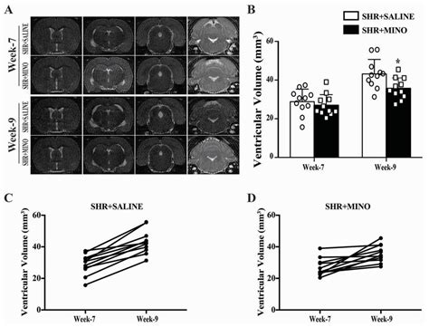 Delayed Minocycline Treatment Ameliorates Hydrocephalus Development and ...