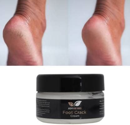 JOYHERBS Feet Crack Heel Repair Cream Smooth Foot Crack Cracked Heel ...
