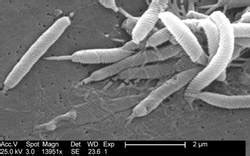 科学网—关于幽门螺杆菌，你想了解的都在这 - 孙占一的博文