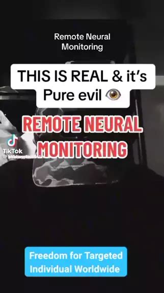 Image result for Remote Neural Monitoring Panel