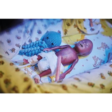 Lifecast Micro-preemie Baby / Extremely Low Birth Weight Baby (ELBW ...