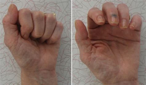 Image result for Free Hand Drawing Using Centerline Method