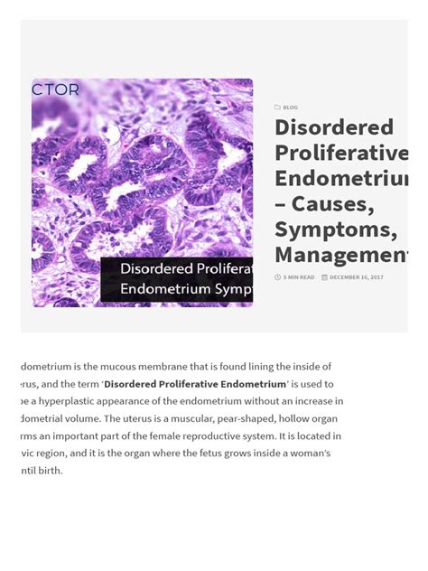Image result for Disordered Proliferative Endometrium