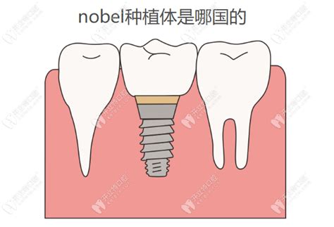 诺贝尔种植牙使用寿命是多少年？还有它的种植体质保几年?,牙齿对比照片-8682赴韩整形网