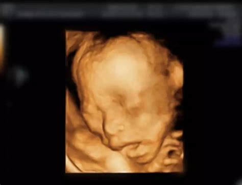 怀孕八个月胎儿彩超_怀孕九个月胎儿彩超 - 随意云