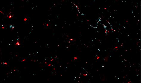 Image result for Injection Reactions