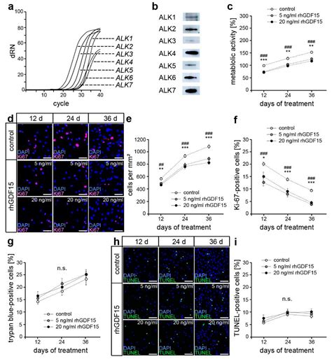 GDF15 promotes the Osteogenic Cell Fate of Periodontal Ligament ...