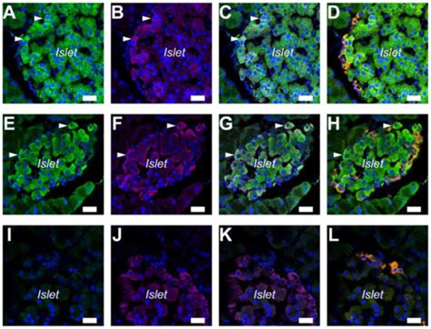 IJMS | Special Issue : G Protein-Coupled Adenosine Receptors: Molecular ...