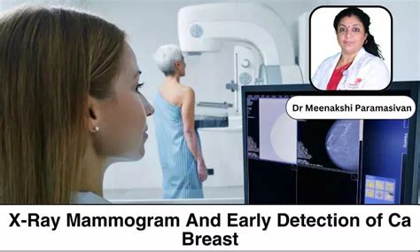 X-Ray Mammogram: Still the Gold Standard for Early Detection of Ca ...