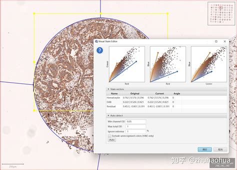 QuPath Plugins 的图像结果