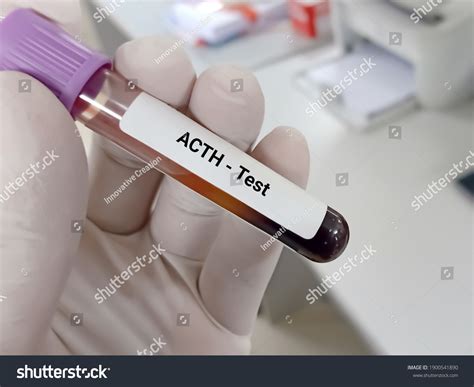 Image result for ACTH Testing