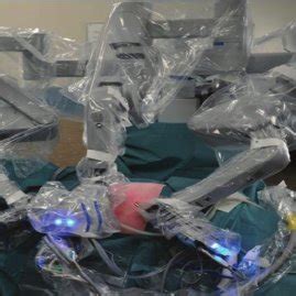 Image result for Hand-Assisted Nephrectomy