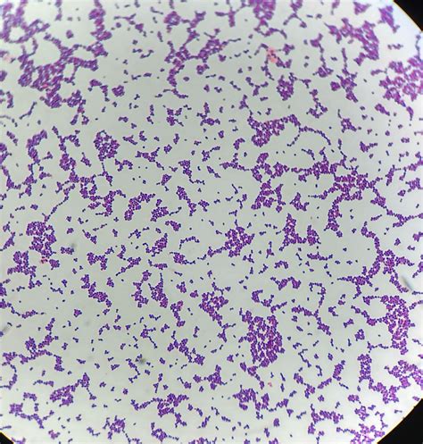 Enterococcus gram stain