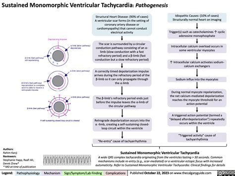 Ventricular Tachycardia Causes