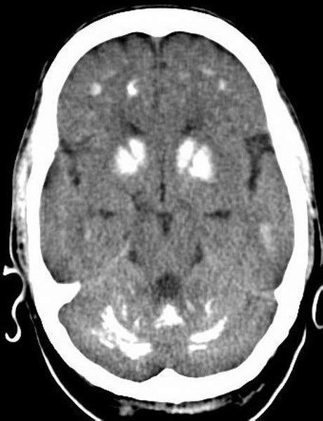 Radioloksabha - Articles