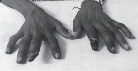 Latest Clinical Journal | Reviews | Medical Research | Guidelines | IJCP