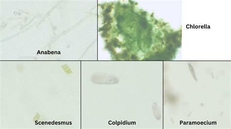 Pond Water Under the Microscope - Biology Notes Online