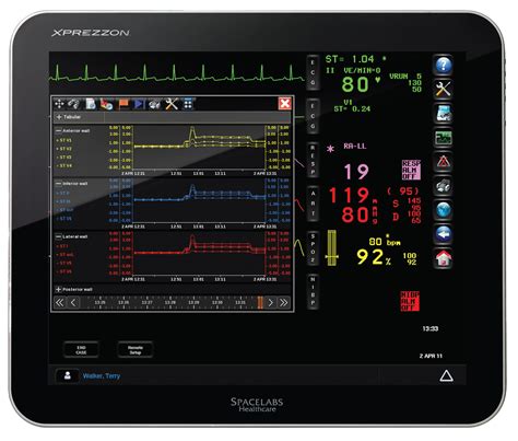 Image result for Spacelab Monitor Training