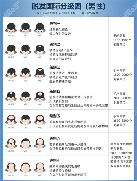 男性/女性植发价格一览表:分享男/女士植发大概是什么价位,胡须种植-8682赴韩整形网