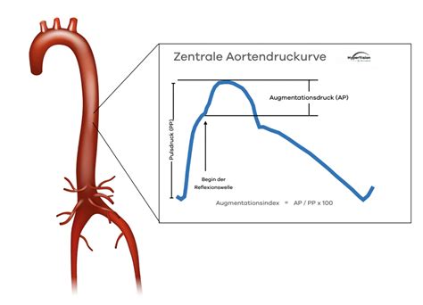 Was ist der zentrale Aortenblutdruck? - hyper10sion.com