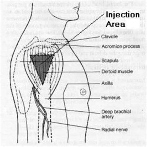 Intramuscular Injection Sites Deltoid CHILDRENS HEALTH IRELAND NURSING