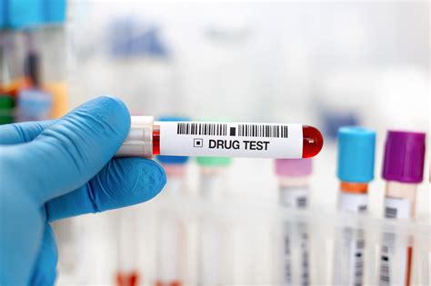 Common Drug Testing Procedures In Minnesota Probation Cases | Drug Testing